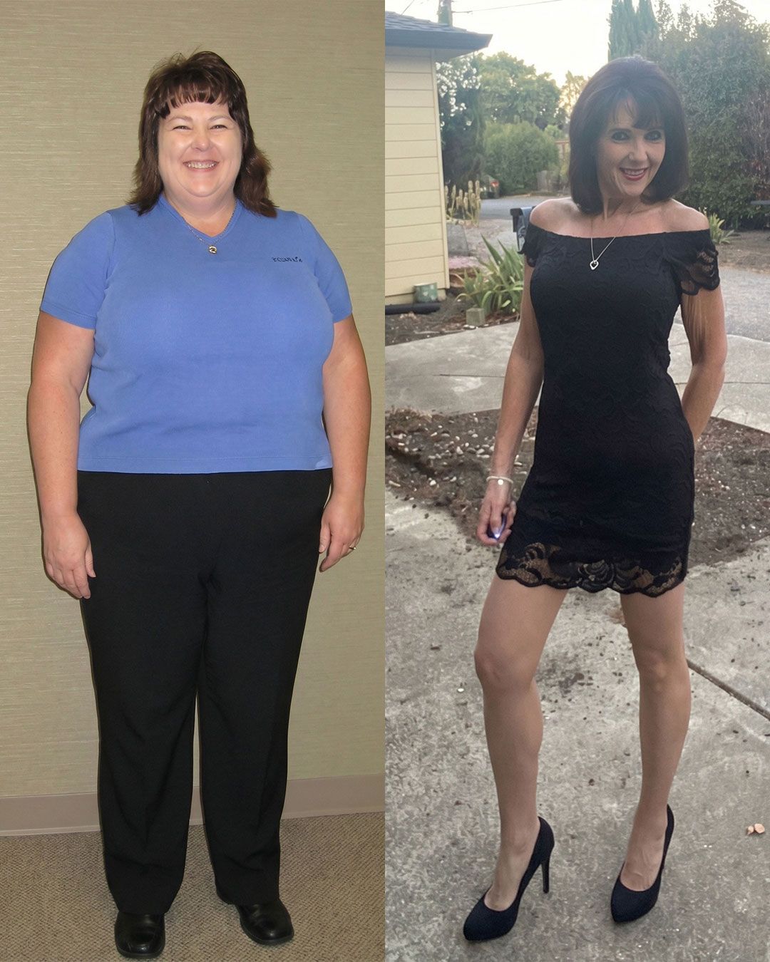 Pam before (left) and after (right) weight loss.