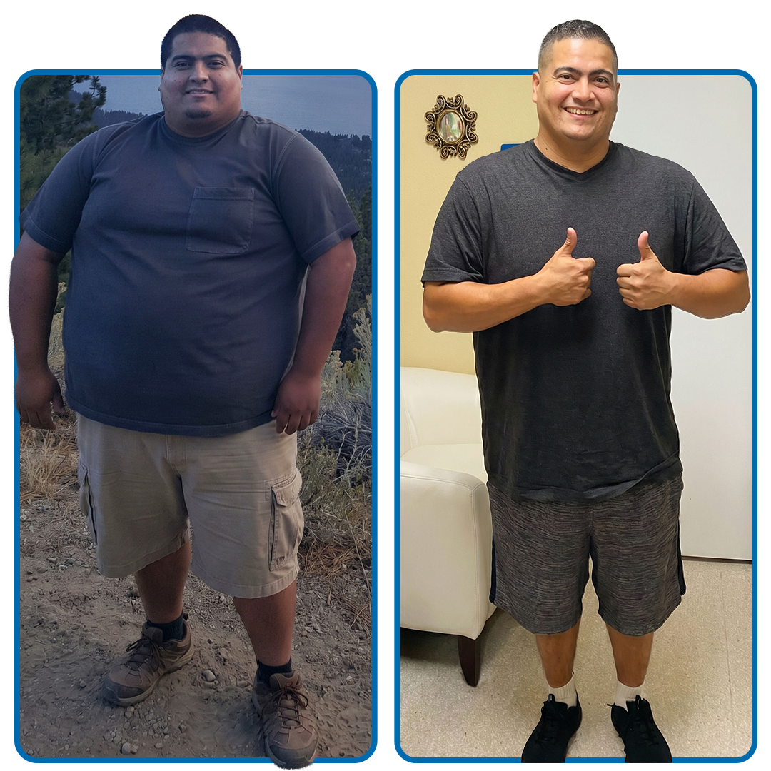 Antonio before (left) and after (right) weight loss.