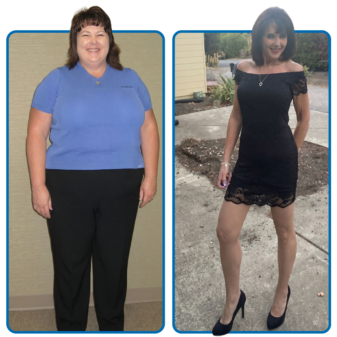 Pam before (left) and after (right) weight loss.